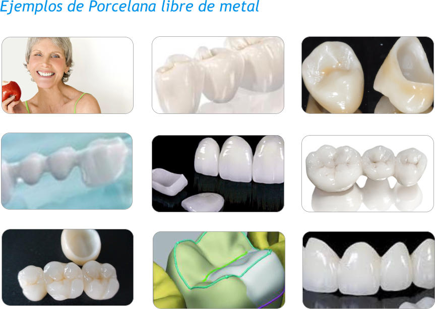 Ejemplos de Porcelana libre de metal