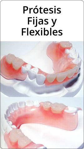 Prtesis Fijas y Flexibles